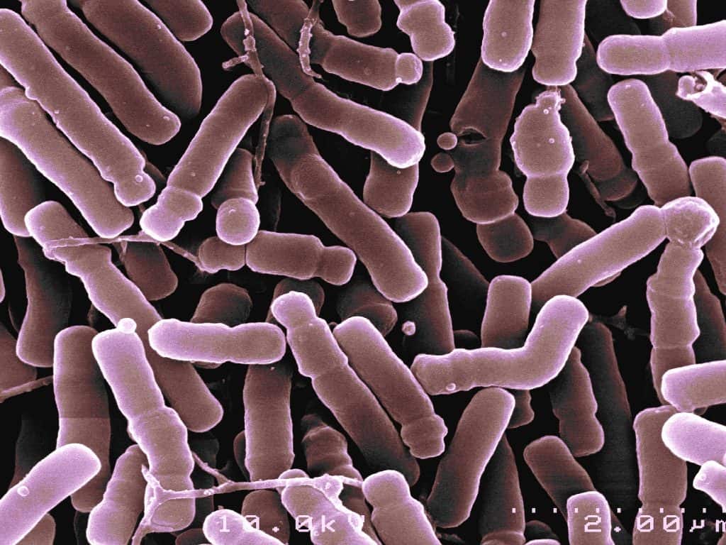 Bifido bacterium longum